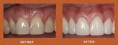 /album/periodontics/periodontics-5-jpg/